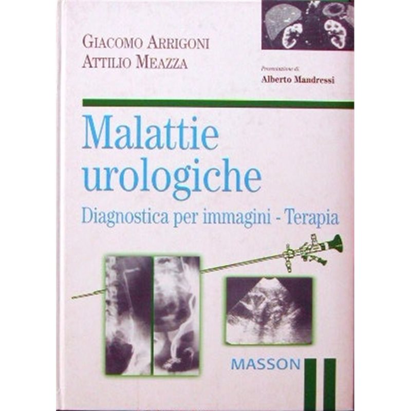 Malattie urologiche